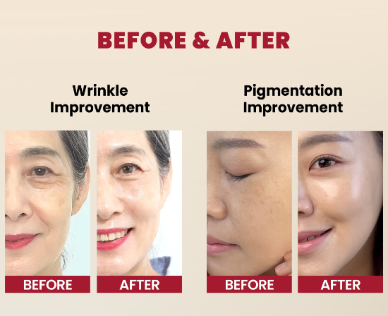 Fotos comparativas del antes y el después de dos mujeres muestran una mejora visible de las arrugas (izquierda) y una reducción de la pigmentación de la piel (derecha) tras usar Bemba. KSECRET - Suero SEOUL 1988: Liposoma Retinal al 2% + Ginseng Negro. Cada set incluye una etiqueta con el ANTES y el DESPUÉS.